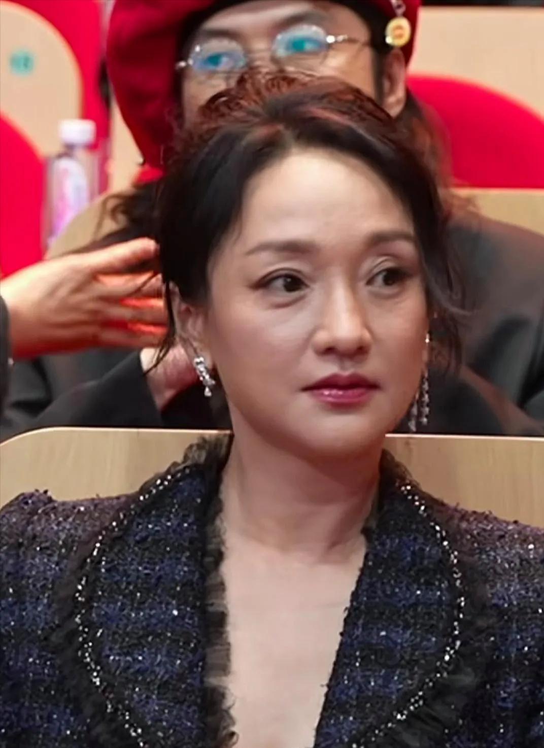 周迅应该没有做过医美，看她这“糟糕”的皮肤状态，整个人太显老了，脸部松弛下垂严重