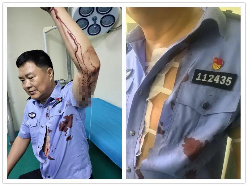 泪目！民警硬抗尖刀，30针缝合太揪心
 
9月13日，内蒙古巴彦淖尔一男子王某某