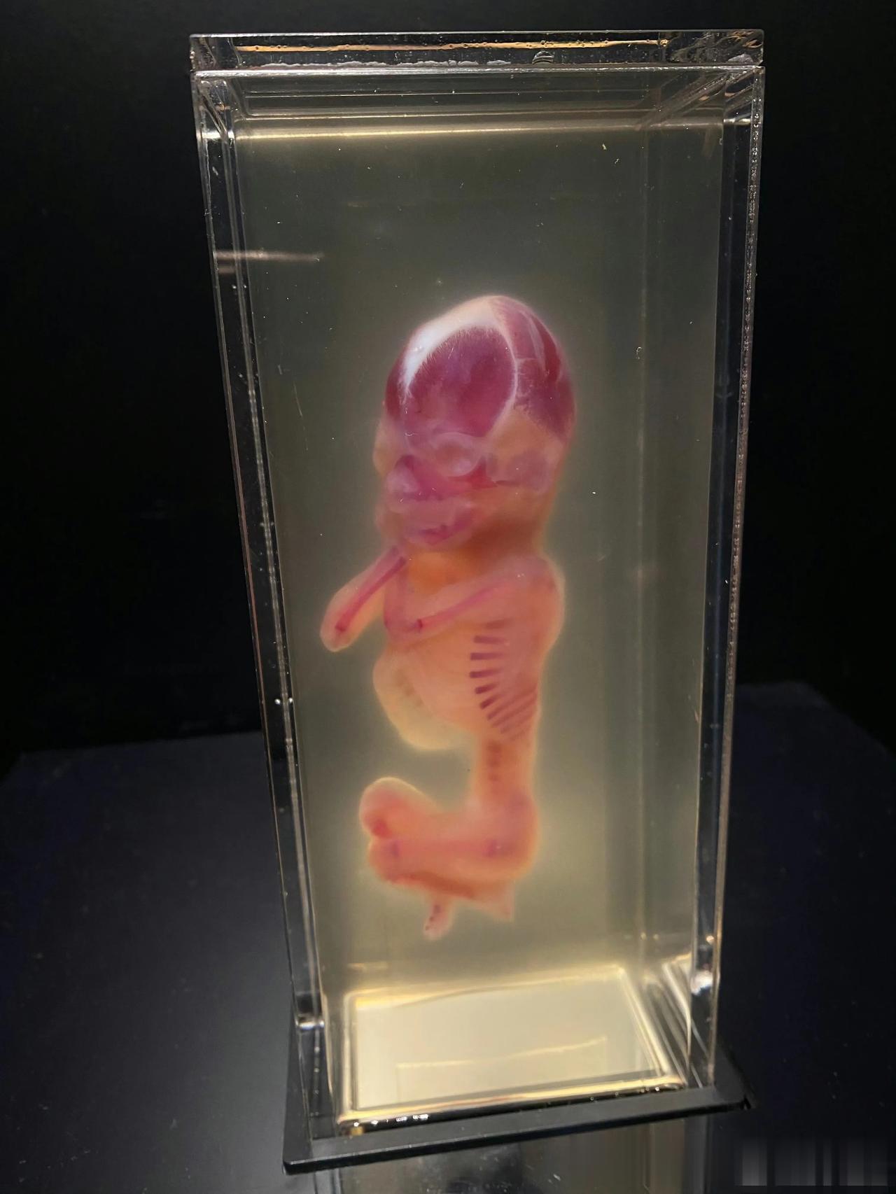 参观荷兰阿姆斯特丹人体世界博物馆 ​​​

人体博物馆是一座高35米的人形建筑，