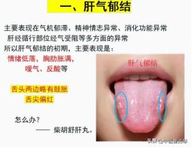 肝气郁滞就知道用逍遥丸？分清不同阶段，才能正确疏肝、养肝
#中医##养生##肝#