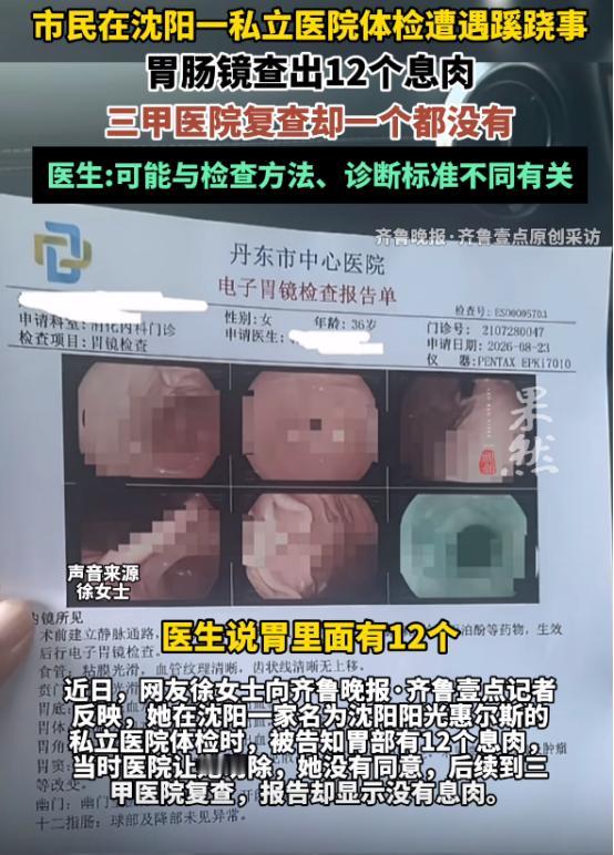 丧尽天良！8 月 22 日辽宁沈阳，女子陪丈夫参加单位体检，顺手做了个胃肠镜。麻