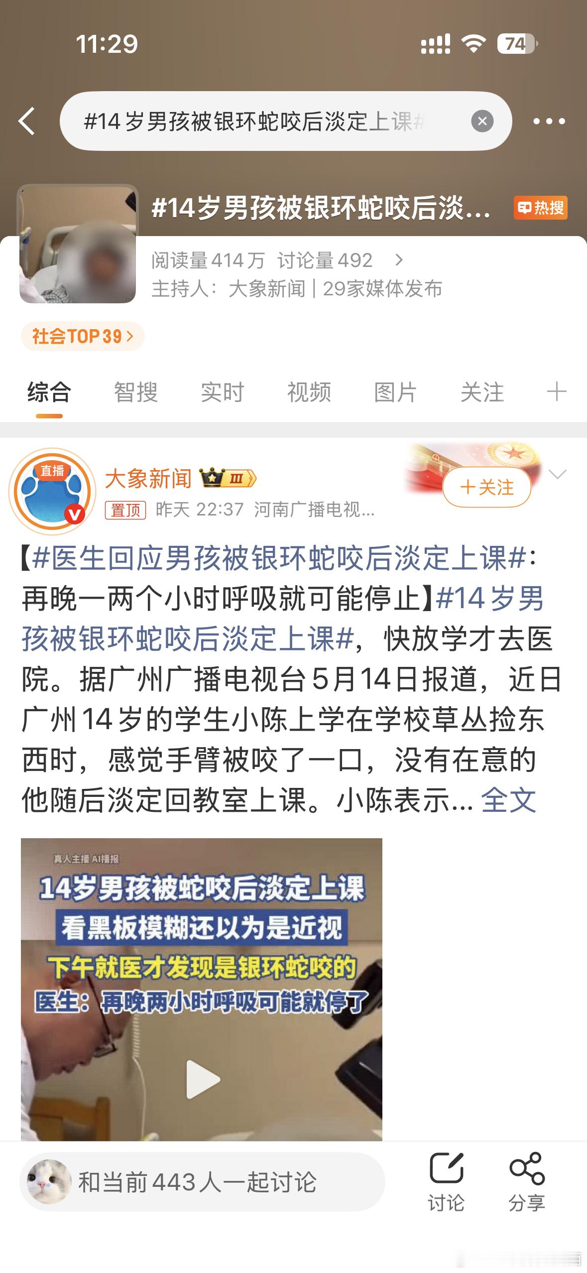 14岁男孩被银环蛇咬后淡定上课看到这个新闻真的又心疼又后怕😭 14岁的孩子被银