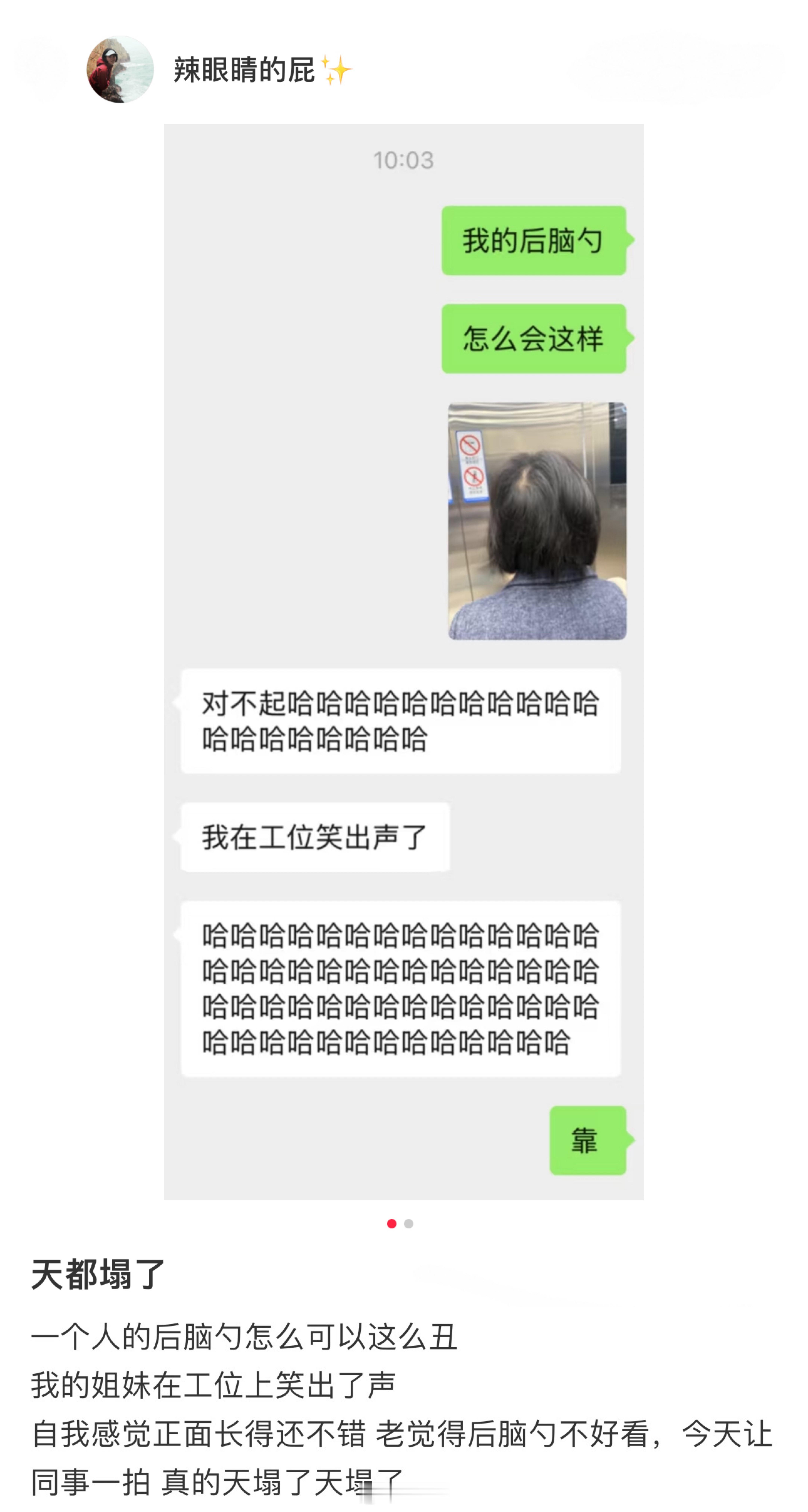 第一次看到后脑勺显老的……[哆啦A梦害怕] ​​​