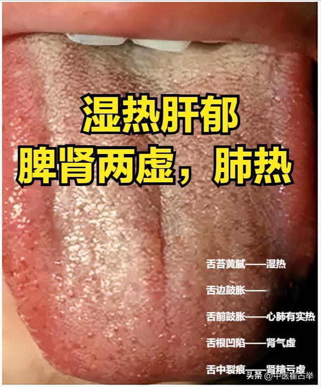 这些天都在坚持给大家看舌象
今天再强调一下
看舌象，没问题
只要你留，我看到了就