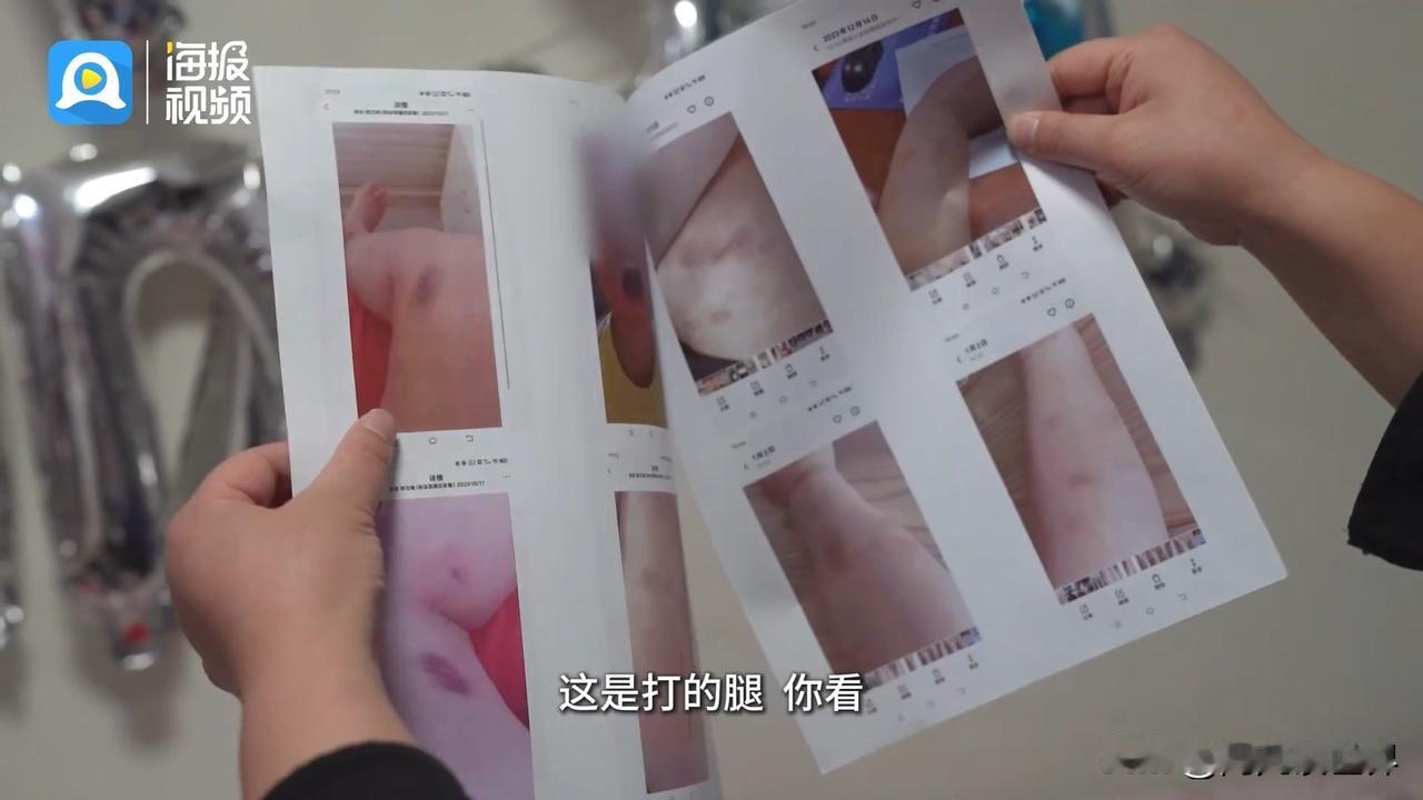 孕期被扇到满嘴是血、剖腹产伤口被打崩开，多次报警求助只换了短暂的喘息。恩施女子小