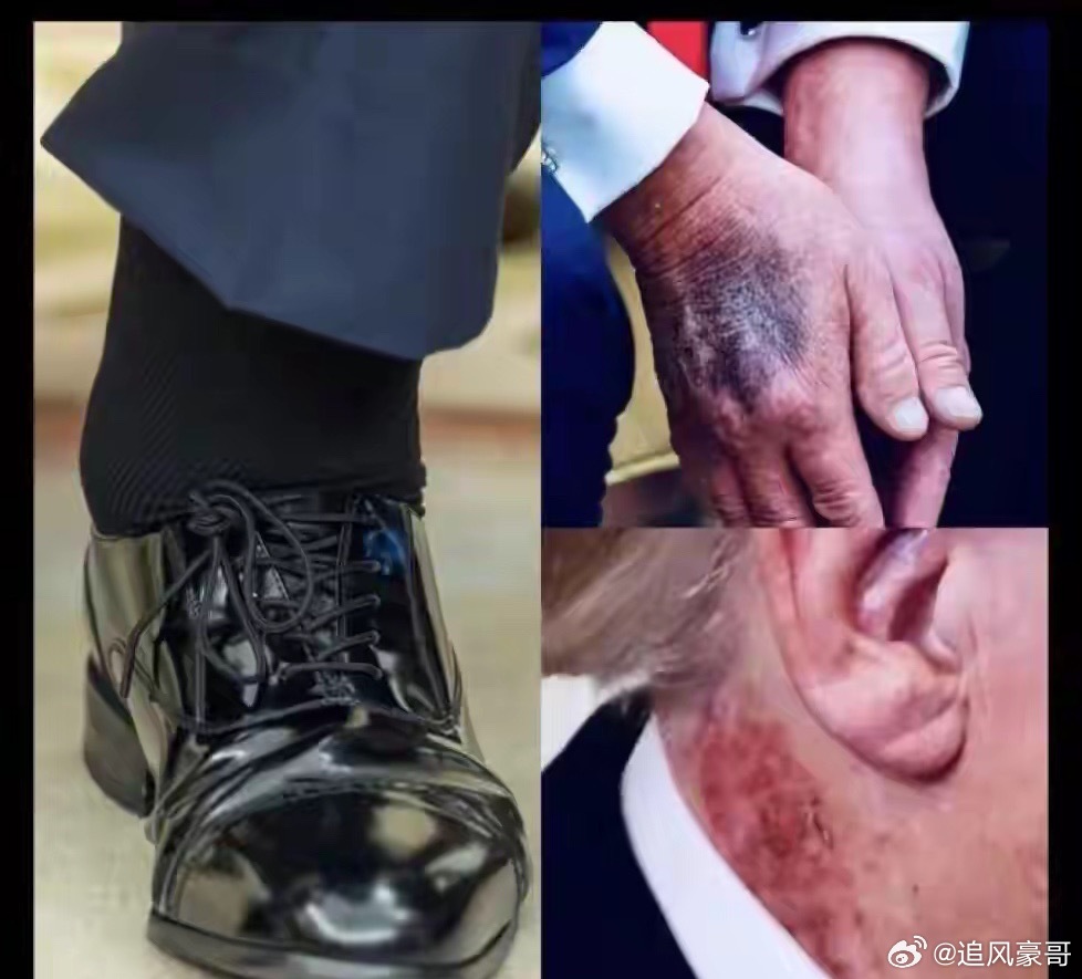 特朗普被爆住院情况危急？社交账号由他人代写？局势将何去何从？“特朗普病危”、“白