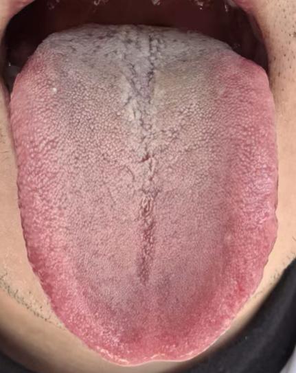 气血亏虚易体虚，中医三步养血通脉，慢慢调理固根本






对于男同志而言，要