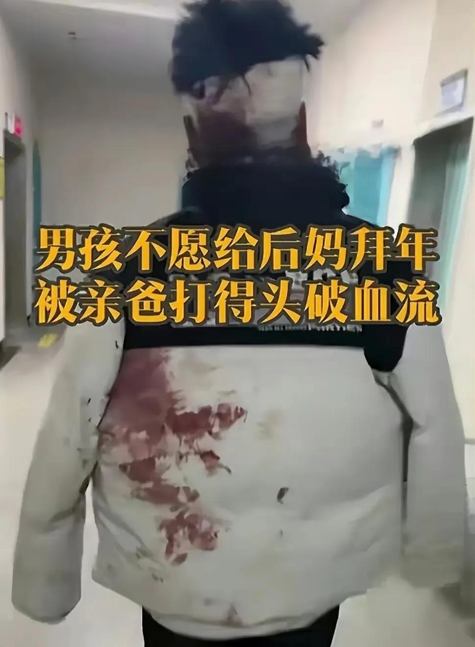 太惨了！！大年初一，一名当老师的亲爸爸把自己18岁的儿子打进了医院。起因很简单，