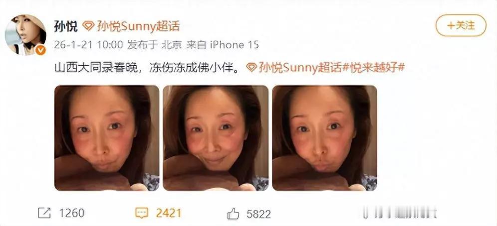 春晚录制出事故，知名歌手意外被烫伤，这谁能想到啊！春晚那可是全国观众都关注的大舞