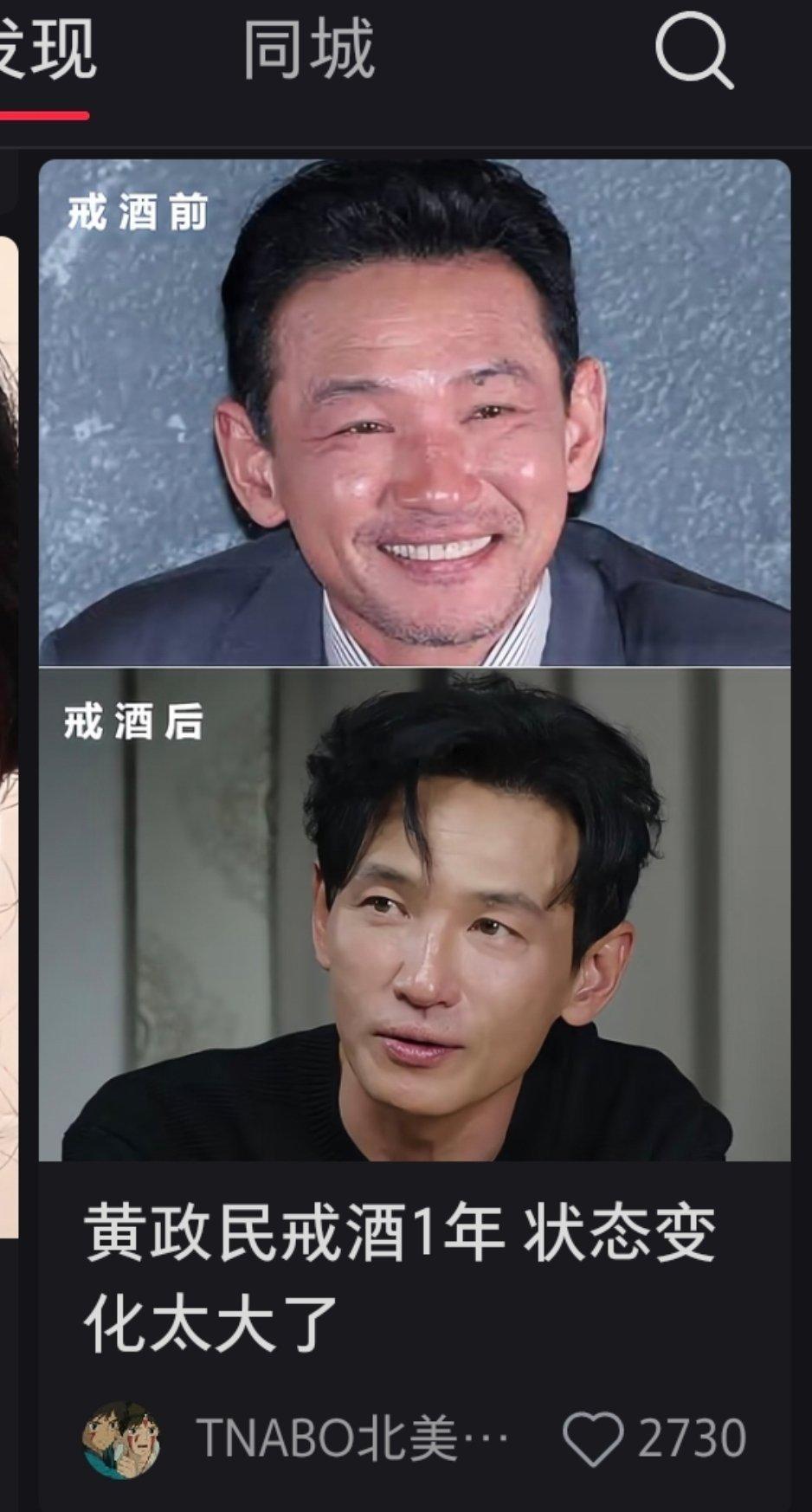 我其实对说黄政民拉皮变成现在这样我是有点无语的。很多人没搞懂拉皮到底能改变什么、