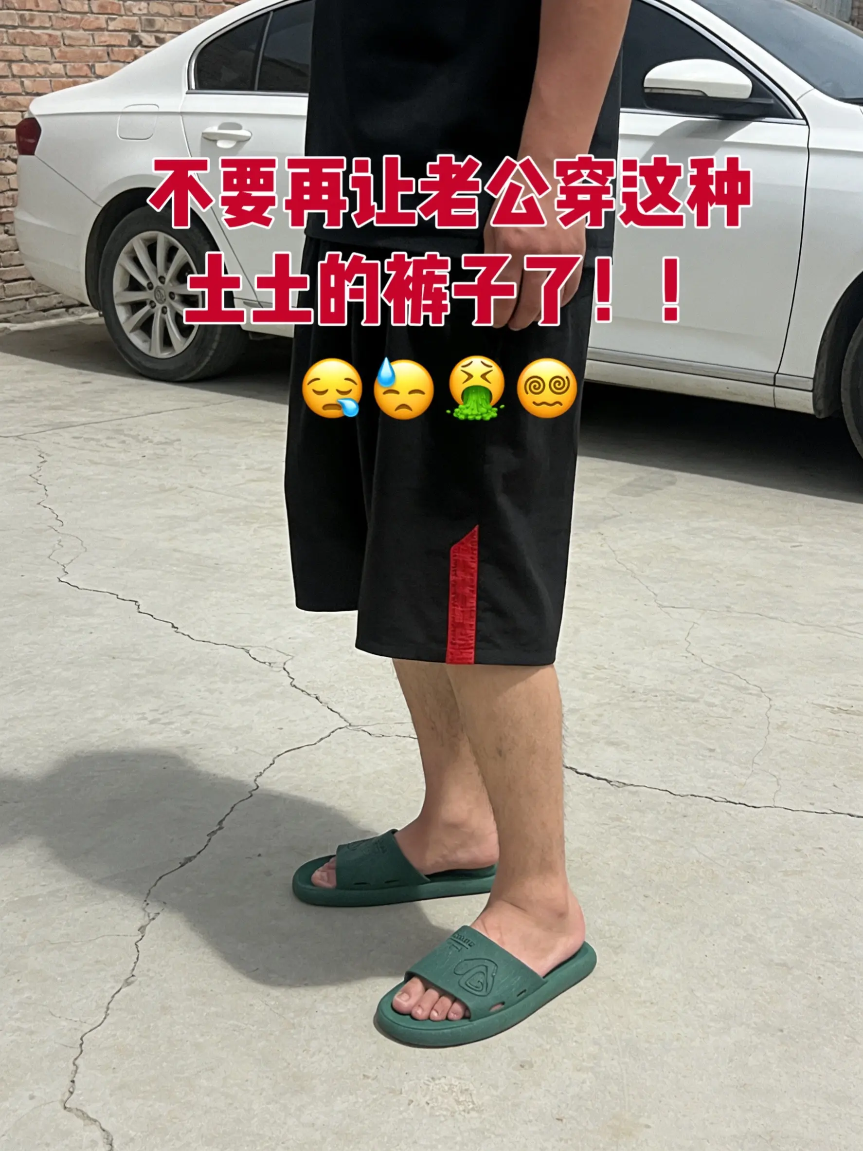 短裤穿搭 夏日舒适穿搭 夏季短裤穿搭 透气短裤搭配 休闲舒适宽松短裤