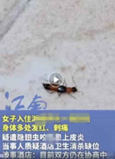 湖南女子入住酒店，被酒店内被隐翅虫毒液灼伤，身上脸上出现大量脓包，去医院检查后医
