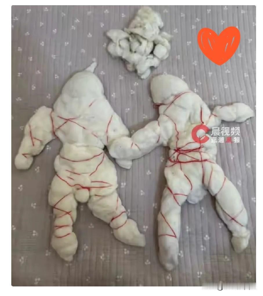 近日，河南焦作，高女士在铺了9年的喜褥里找到了一对缠着红线的棉花小人。

多年来