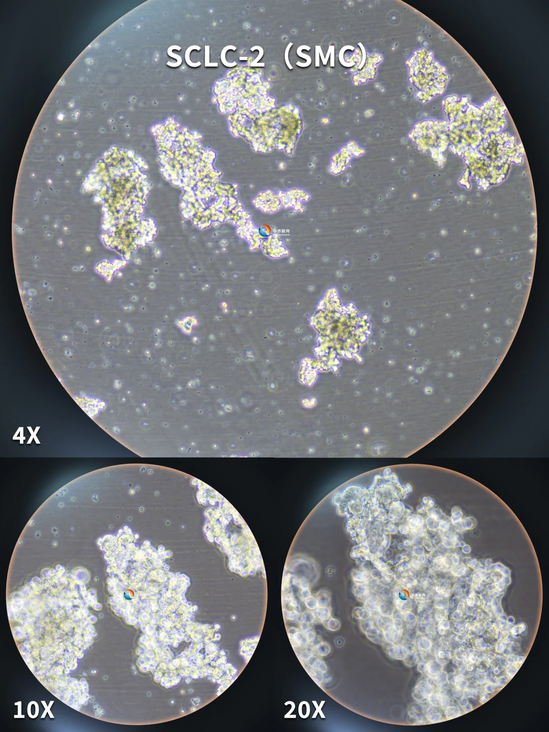SCLC-2（SMC）小鼠小细胞肺癌细胞，惊艳