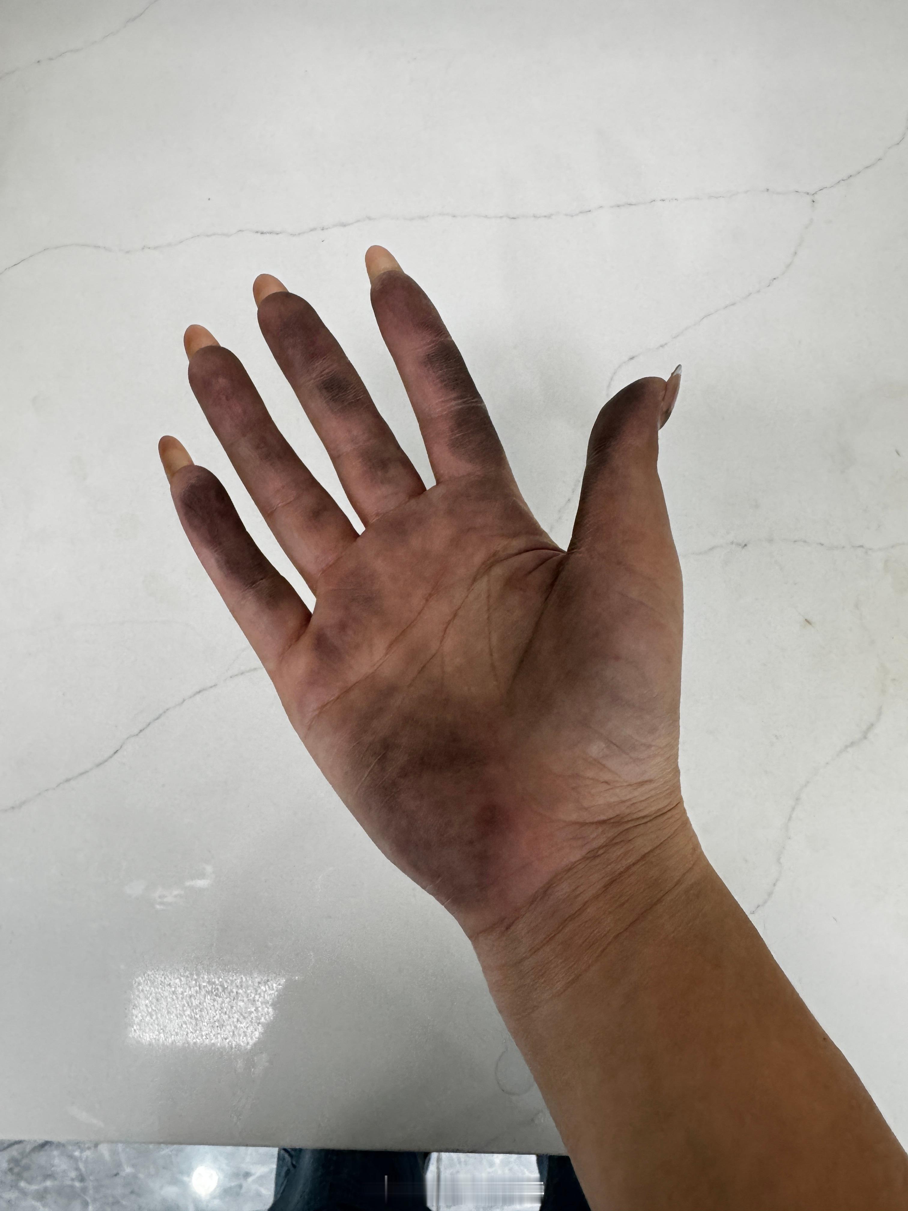 搬砖🧱喝药💊命和药都很苦