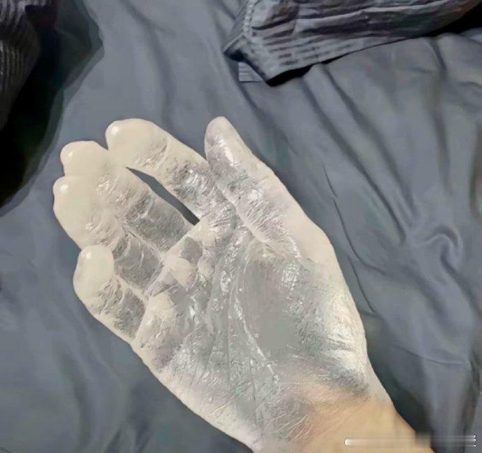 冬季睡前泡脚虽然舒服，有4类人群却不建议泡脚：●足癣根据《手癣和足癣诊疗指南（2