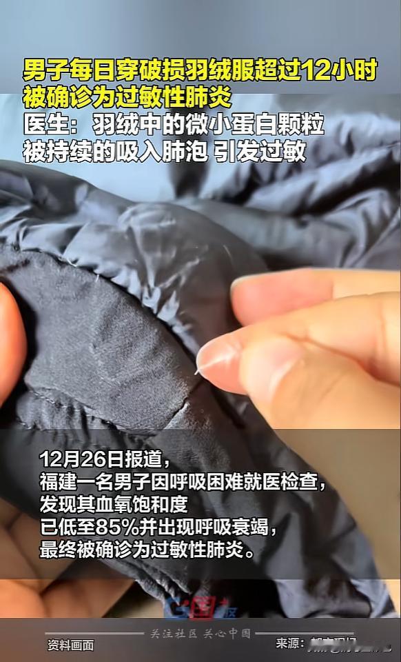 “悲剧还是发生了！”近日，福建，一男子低价网购了件羽绒服，每天穿着超过12小时，