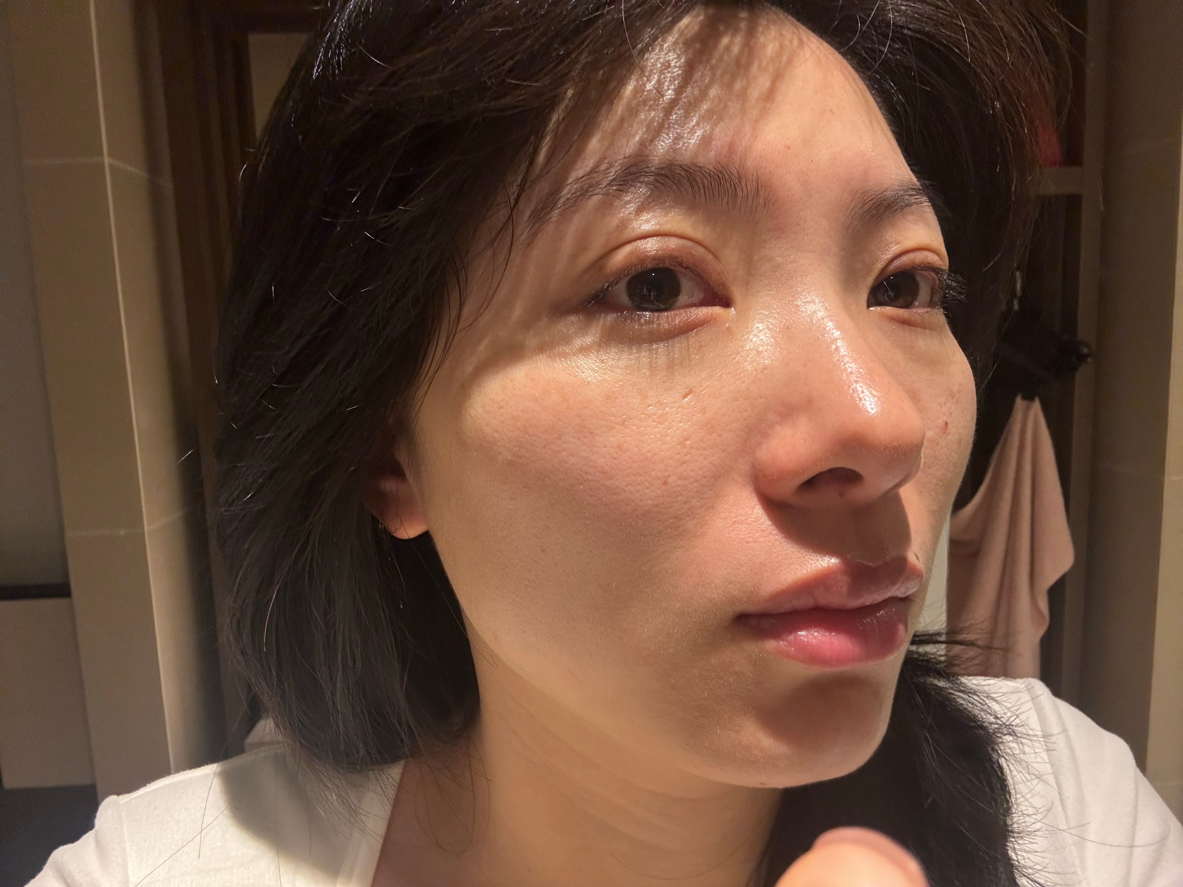 早☀️这两天不知道是过敏了还是感冒了流鼻涕流眼泪鼻子擦破了眼皮宽的跟护城河似的图