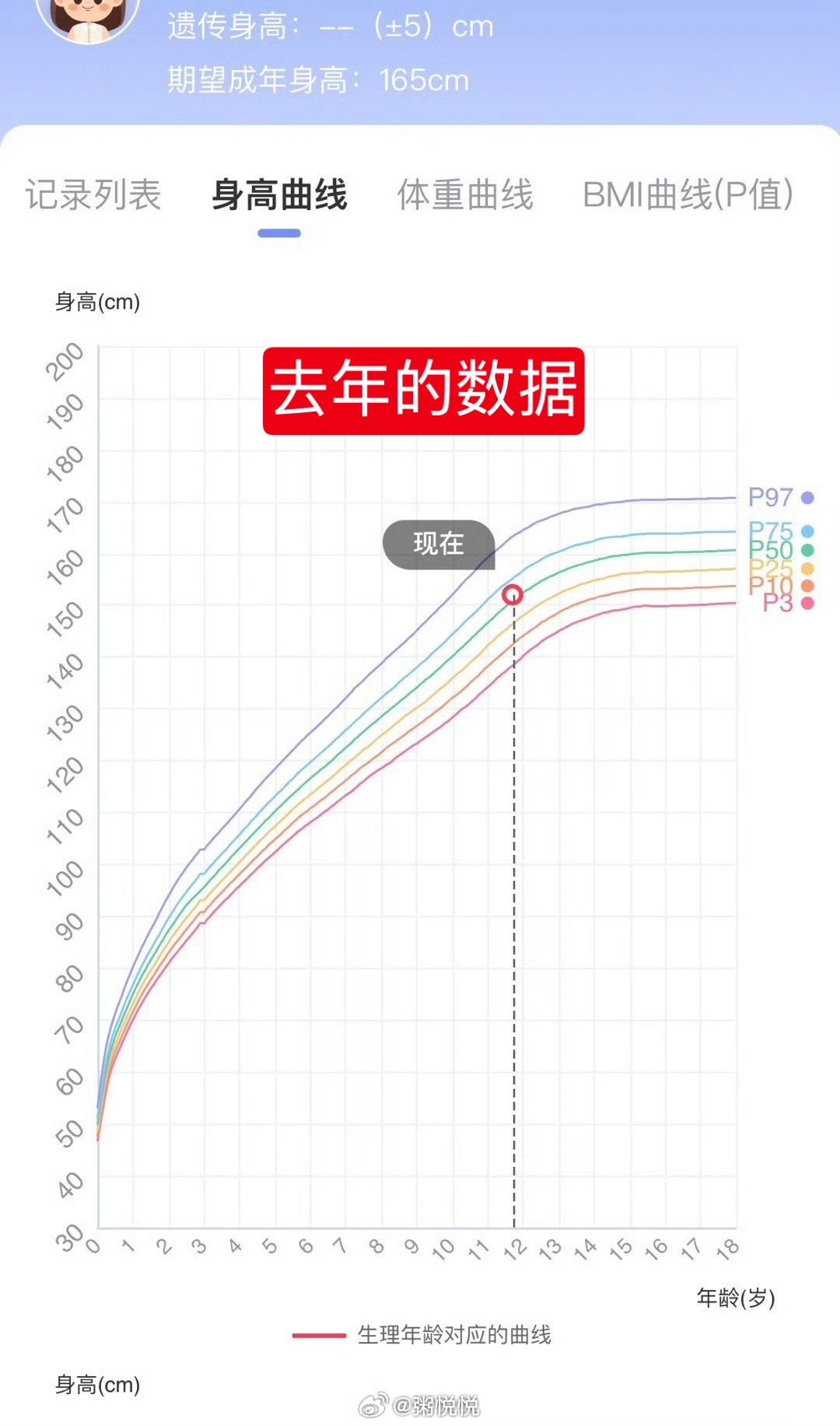 2025年7月19日，带米姐去医院测骨密度。原因是她偏胖，我担心可能会对生长发育