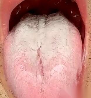 有些道理，得伸出舌头才想得通。
一种人，身体里同时住着冰与火。脚踝永远是凉的，可