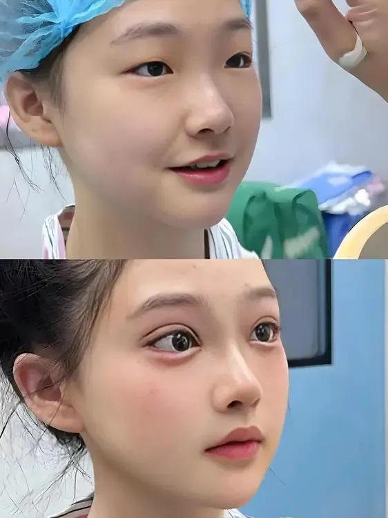 说实话，医美之后确实漂亮。