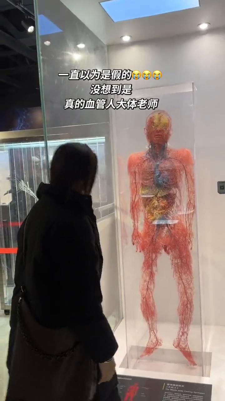 一直以为是假的，没想到是真的。
血管人大体老师。