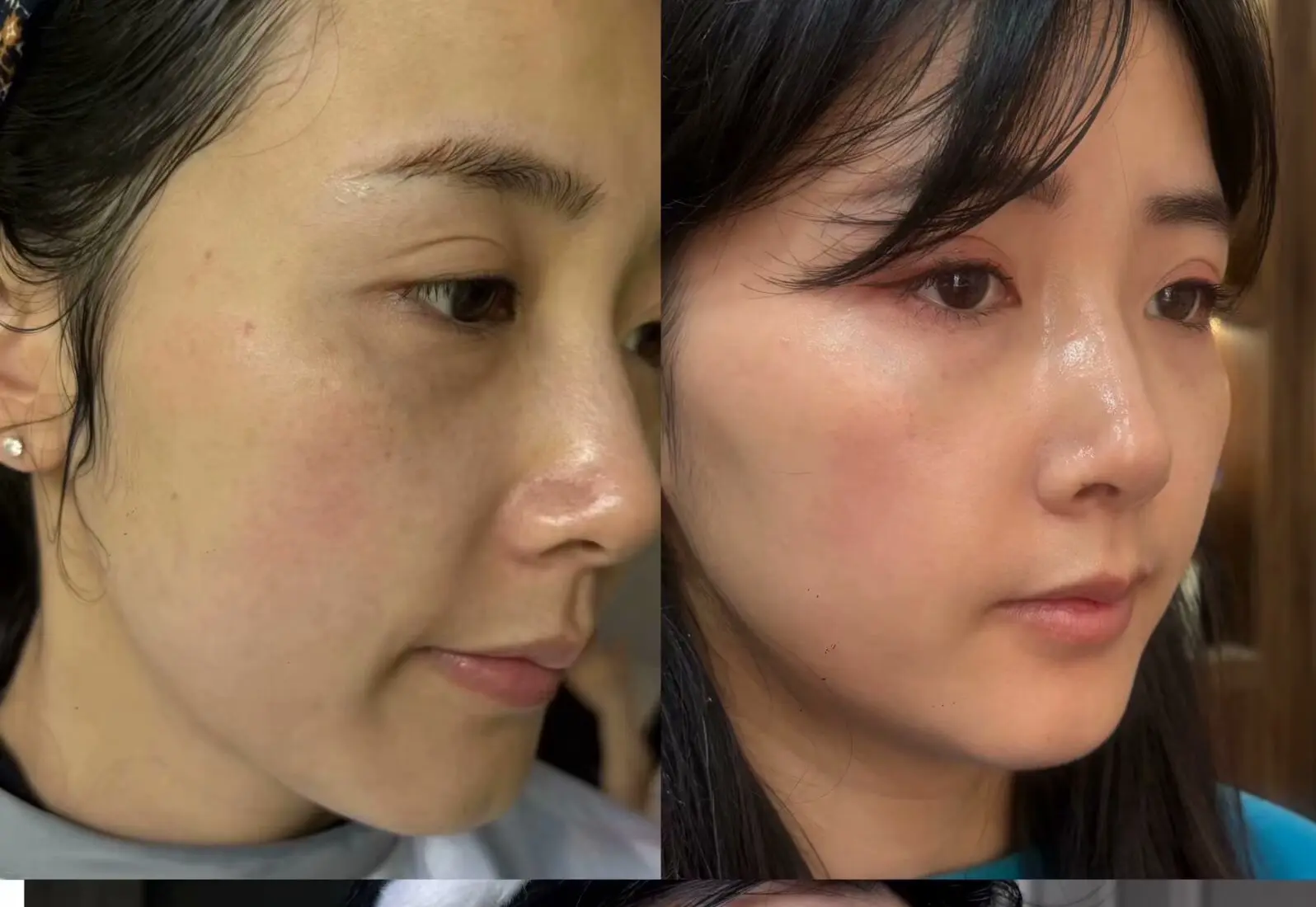 前面苹果纯原相机，很多朋友看到我都以为我做了精雕，或者医美，真没去做任...