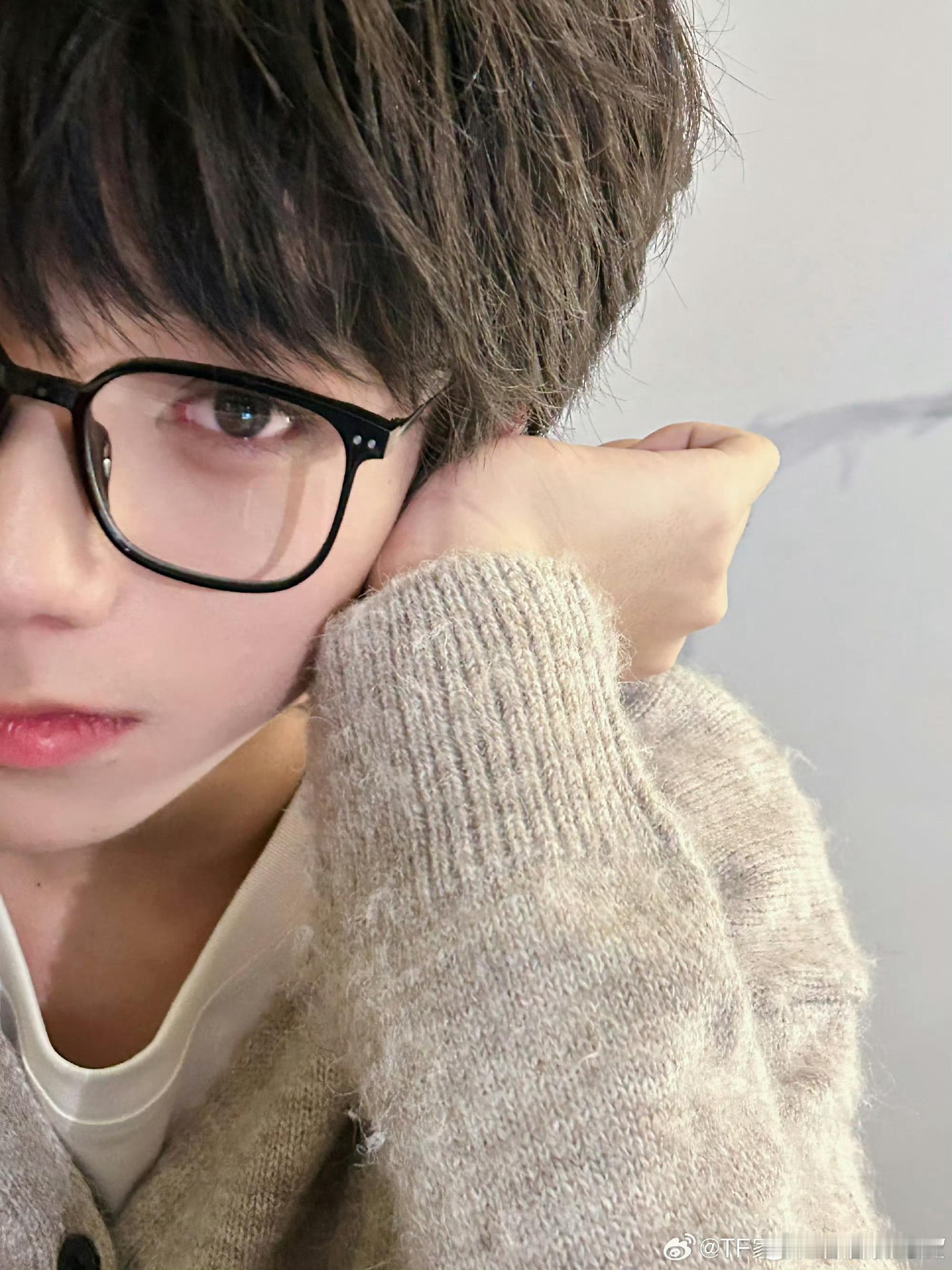时代峰峻回应王橹杰眼睛问题那么好看的眼睛一定要保护好呀！[可怜] ​​​
