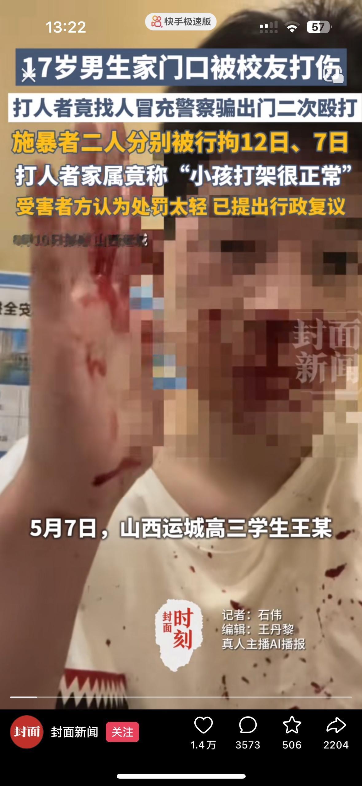山西运城这事儿，简直是闻所未闻，离谱到震碎人的三观了
17岁的少年小雷在家门口被