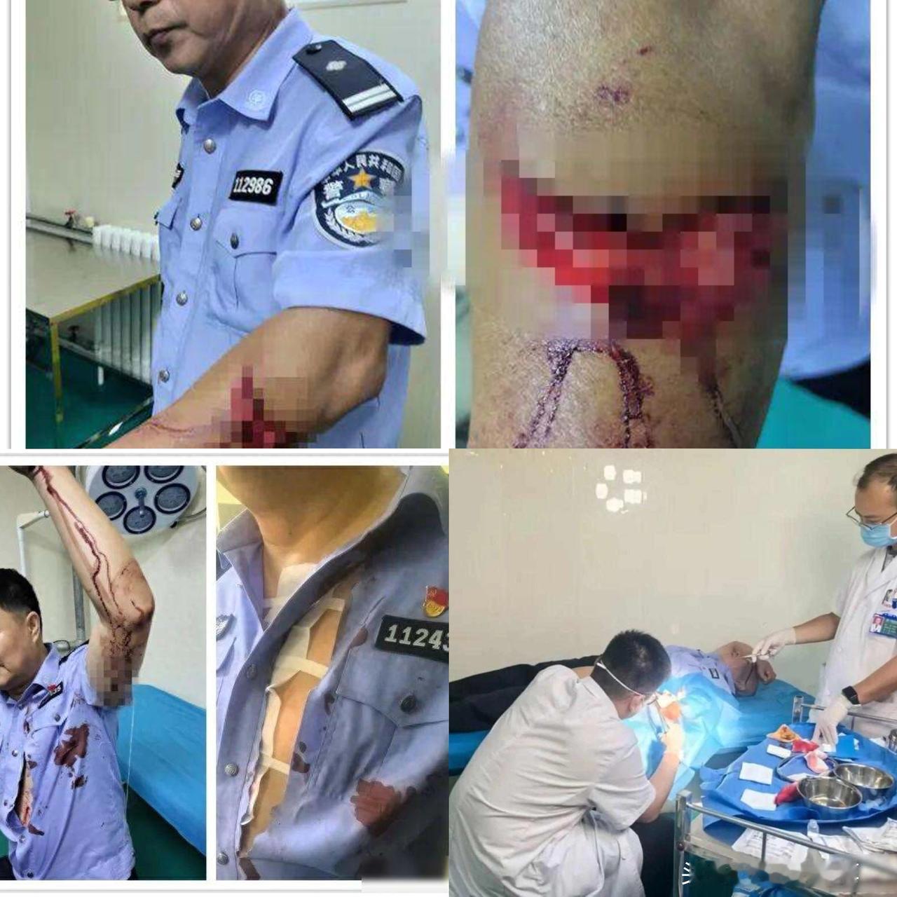 这样的民警谁不爱戴？
血染警服还死死扣住歹徒手腕群众手机拍下的这一幕看哭全网！