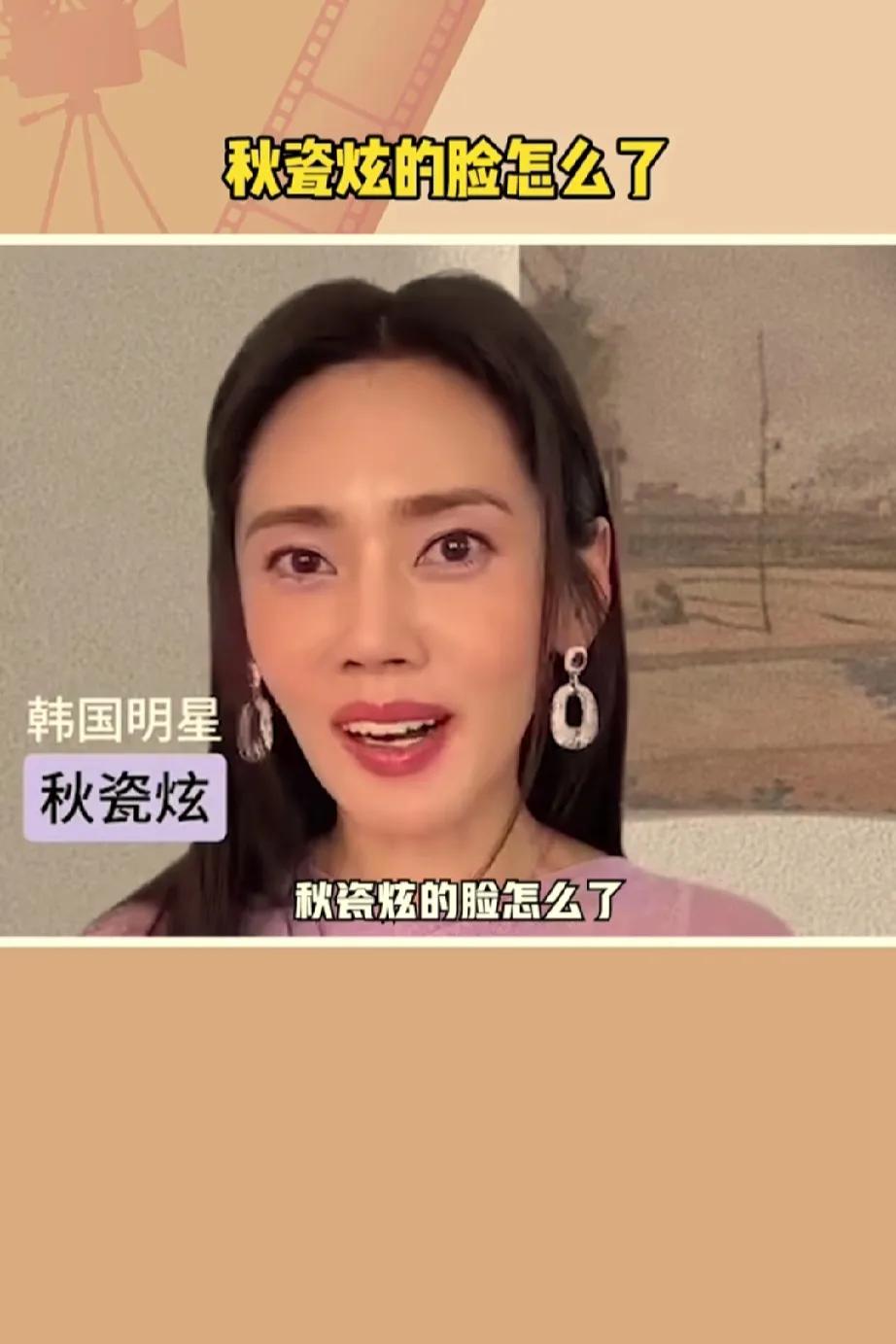 最近韩国好像很流行这种面部脂肪很薄的感觉，可能是去做抗衰又做了牙齿贴片，要不就是