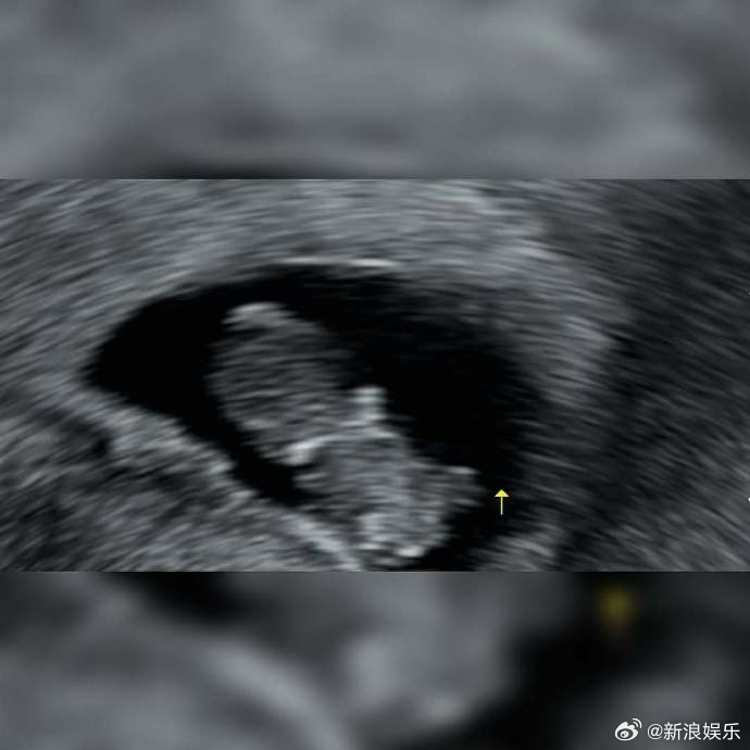 AOA徐酉奈怀孕AOA徐酉奈当妈 4日，AOA前成员徐酉奈官宣怀孕，她在社交平台