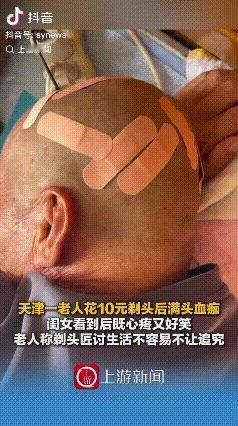“哭笑不得”天津，67岁的刘大爷去理发店花10块钱剃头，因理发师理发师技能不熟练