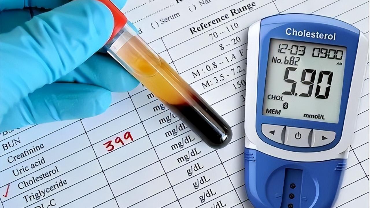 美国大学研究：高血脂是全身性疾病，不能只降脂，还要控制好这些

一说到高血脂，很