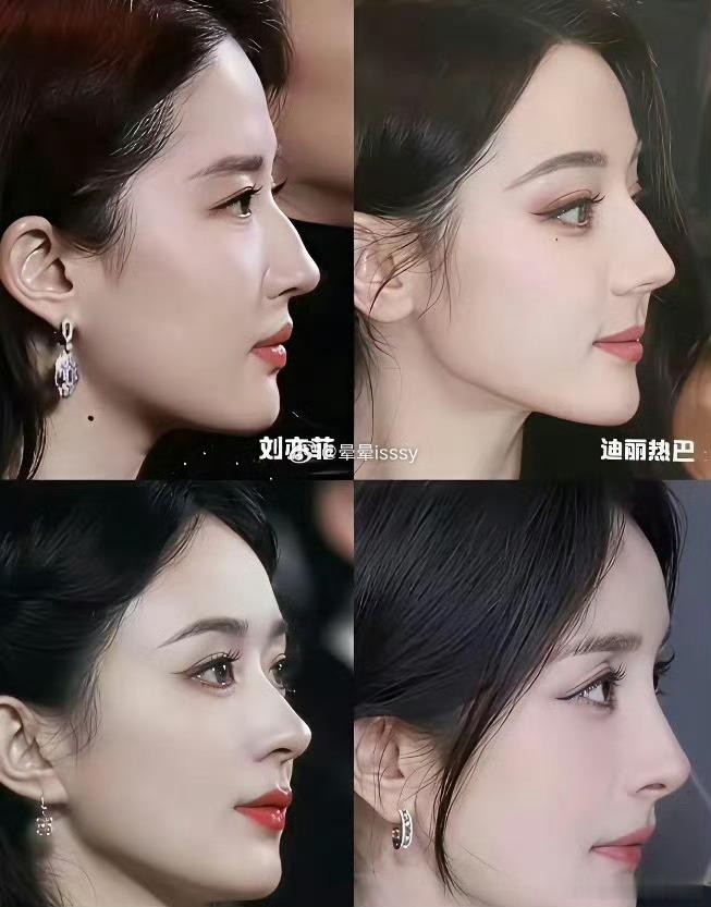 女明星的名品鼻