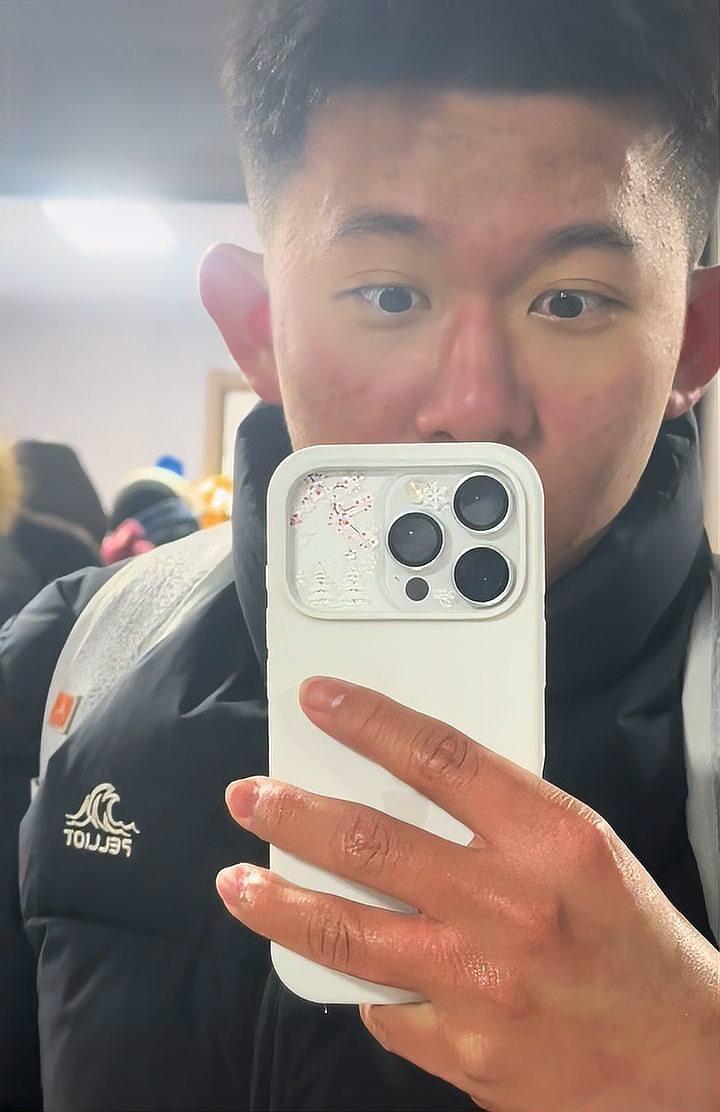 吉林16岁男生勇闯哈尔滨冰雪大世界，未戴帽子手套，脸被冻伤，眼眶发青！他提醒大家