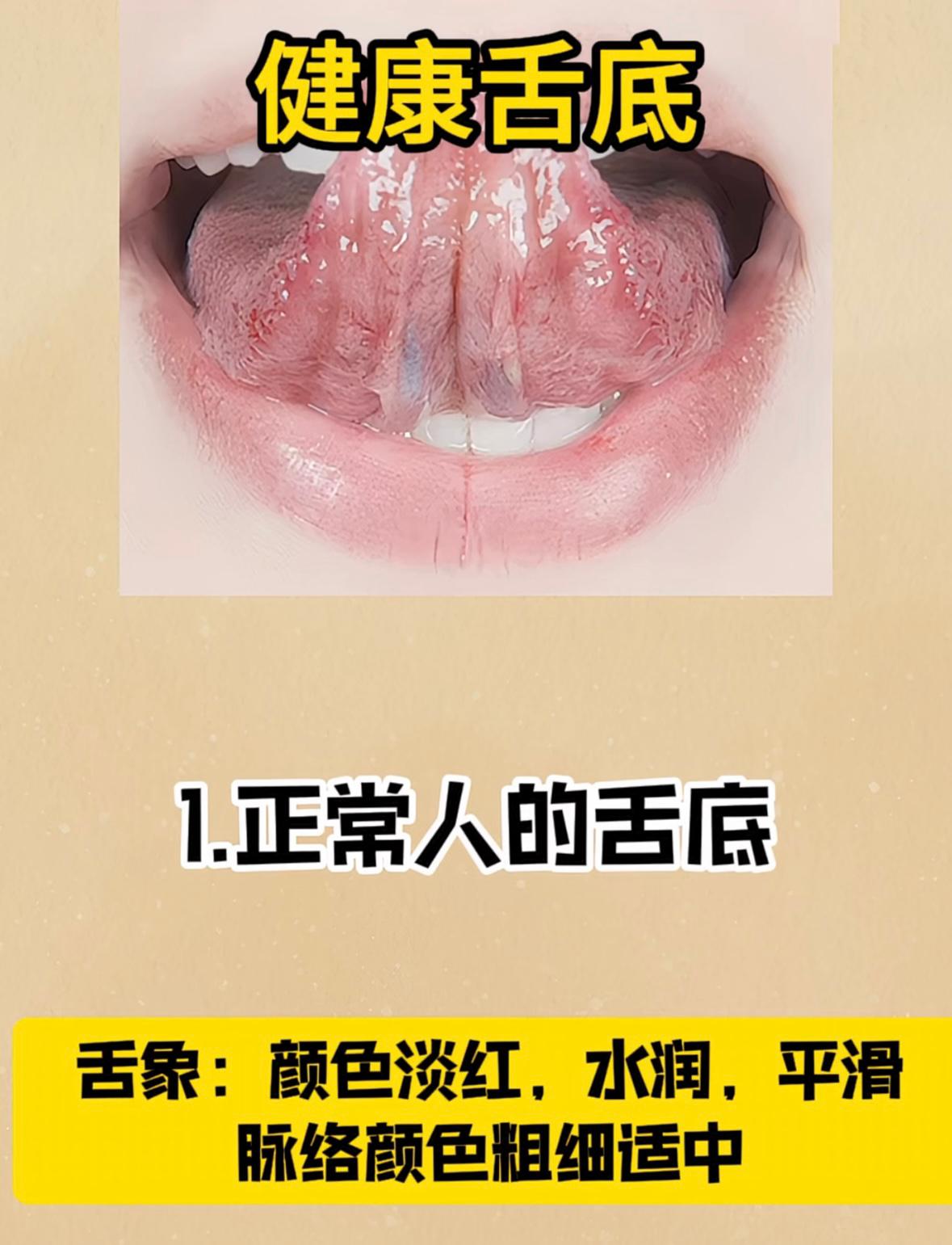 下午不坐诊，继续给大家公益看舌头，你发我就看，1个不漏！

今天给大家分享：中医