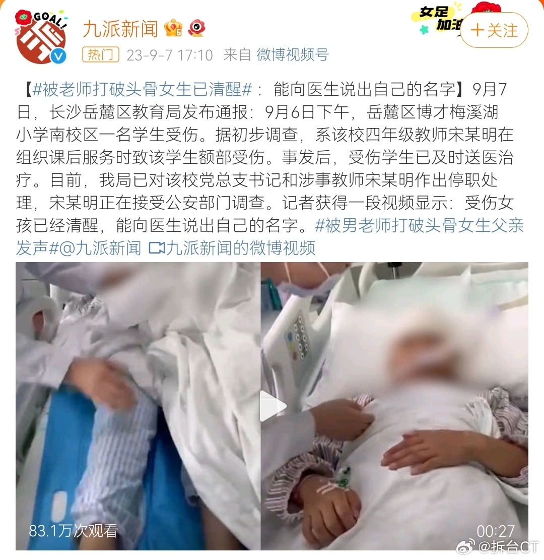 #被老师打破头骨女生已清醒#最新消息：被打破头骨的女生已经清醒。9月6日下午发生