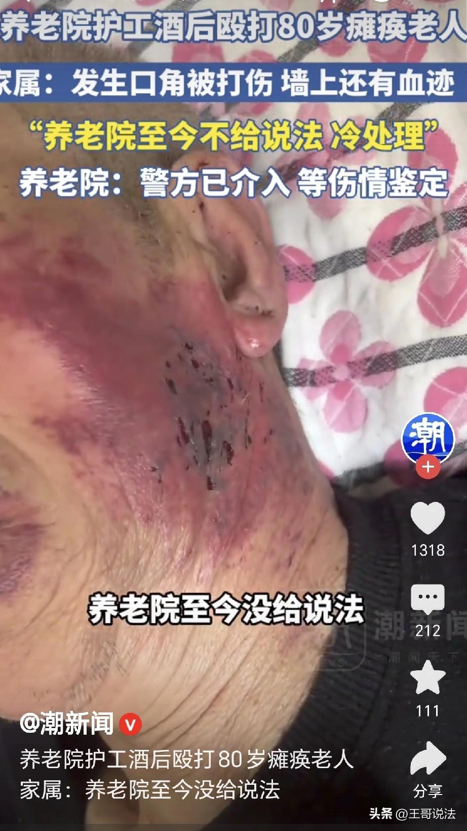 “天理不容！”天津，一养老院里，80岁瘫痪的大爷被喝完酒的护工打伤，大爷满脸青紫