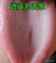 肝主疏泄，肝郁是很多疾病的源头！今天教你通过舌象和症状，快速辨别 3 种肝郁类型