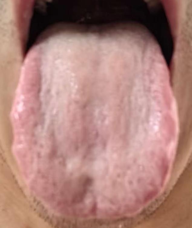 精门难以固摄，到底该如何正确调理？






不少朋友前来咨询，遇到精门不固、