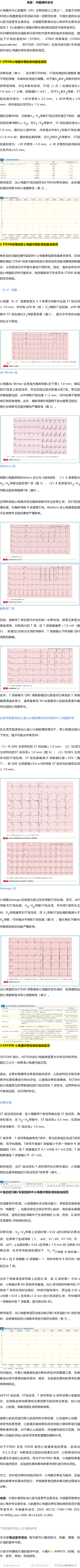 心肌梗死心电图诊断标准和报告规范中国专家共识发布心电图作为心肌梗死（MI）诊断的