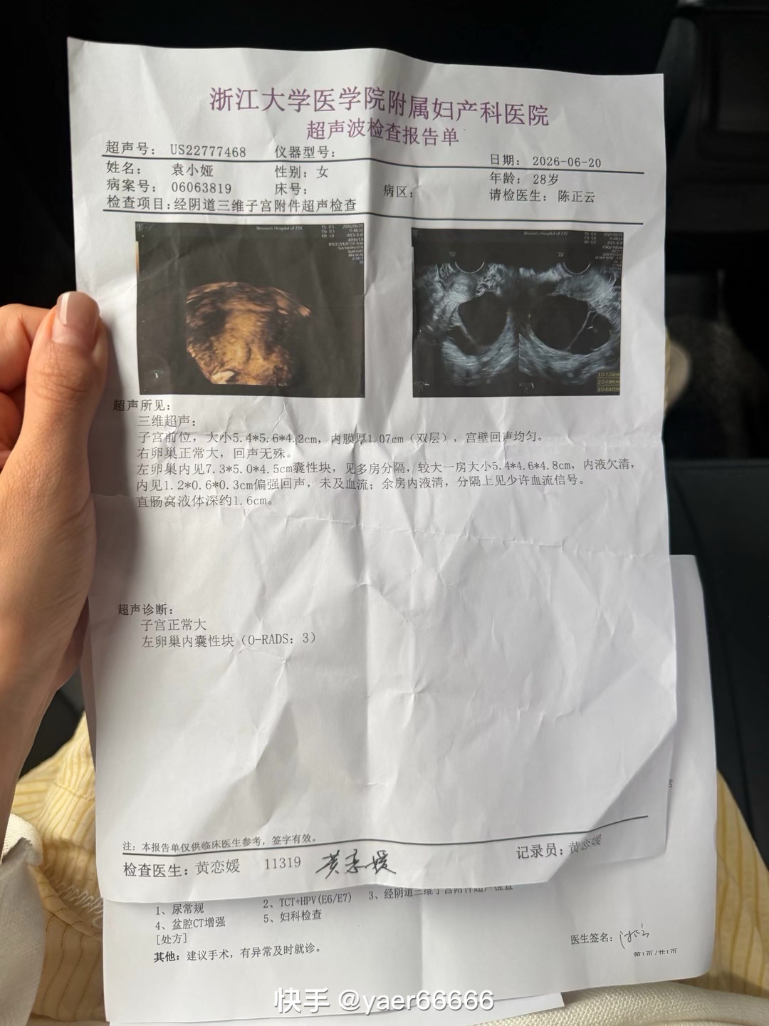 雅儿请假，7cm卵巢囊肿住院手术。 
