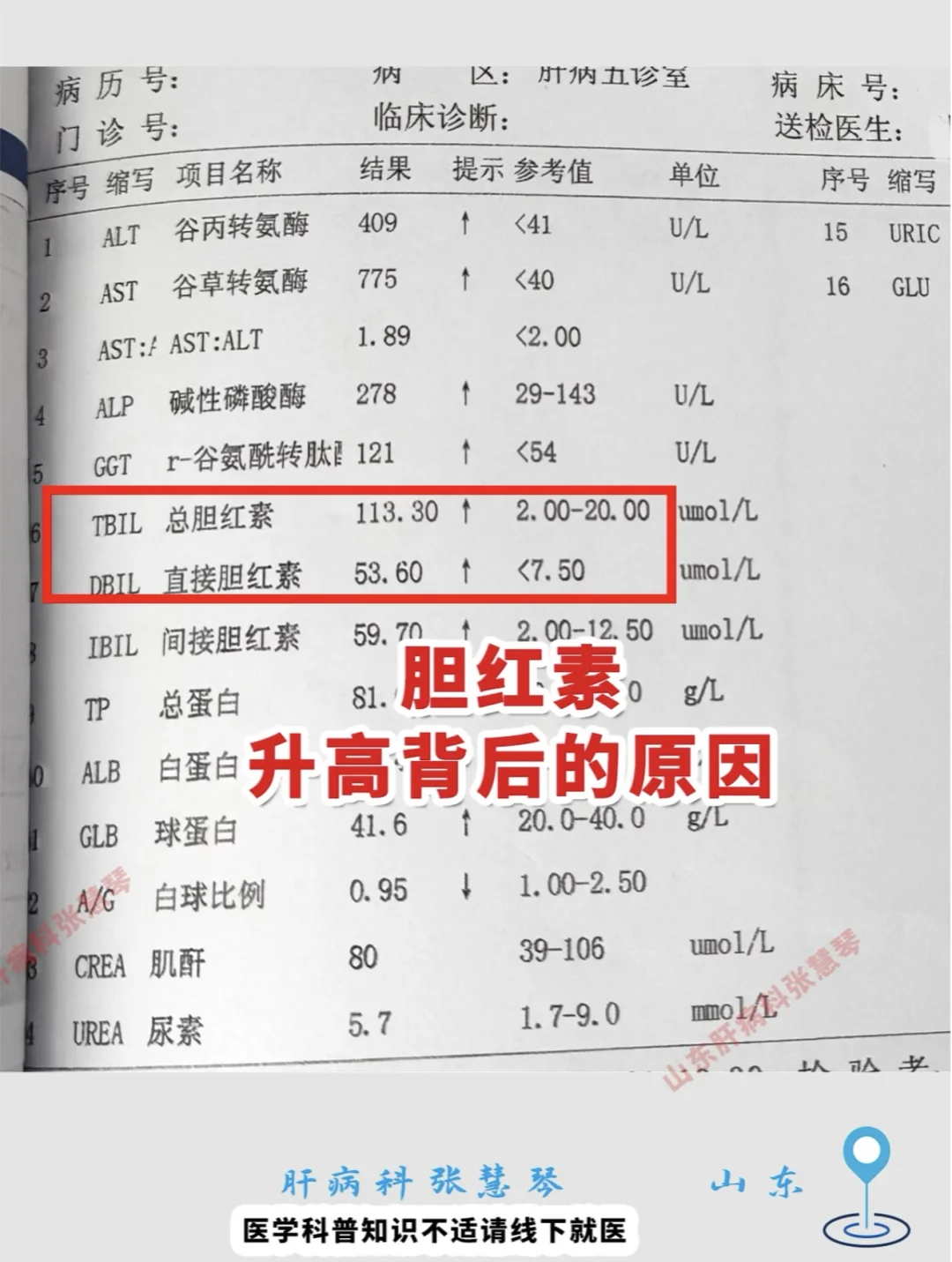 胆红素升高背后的原因，越早知道越好!