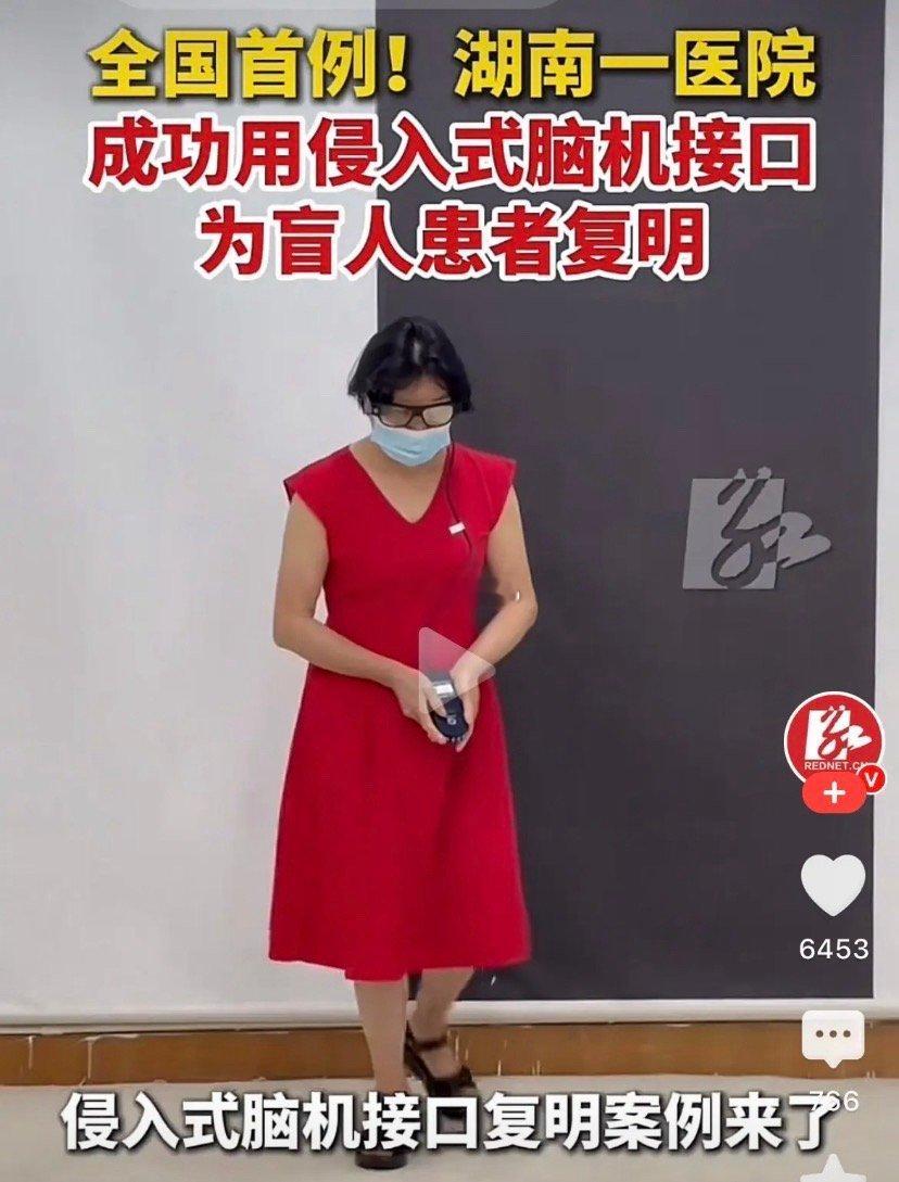 全国首例盲人脑机接口复明成功全国首例！失明十年，脑机接口让她重见光明61岁陈阿姨