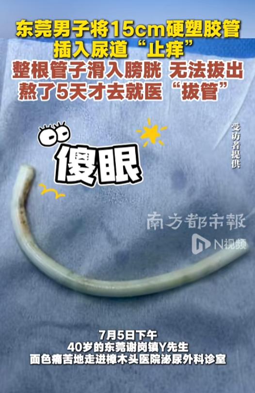 “怎么塞进去的呢？”7月9日报道，广东东莞，一男子感觉尿道瘙痒，他突发奇想，找来