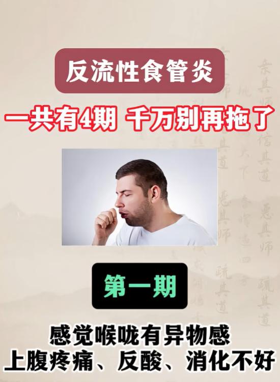 喉咙异物感、反酸烧心，警惕反流性食管炎，一共 4 期