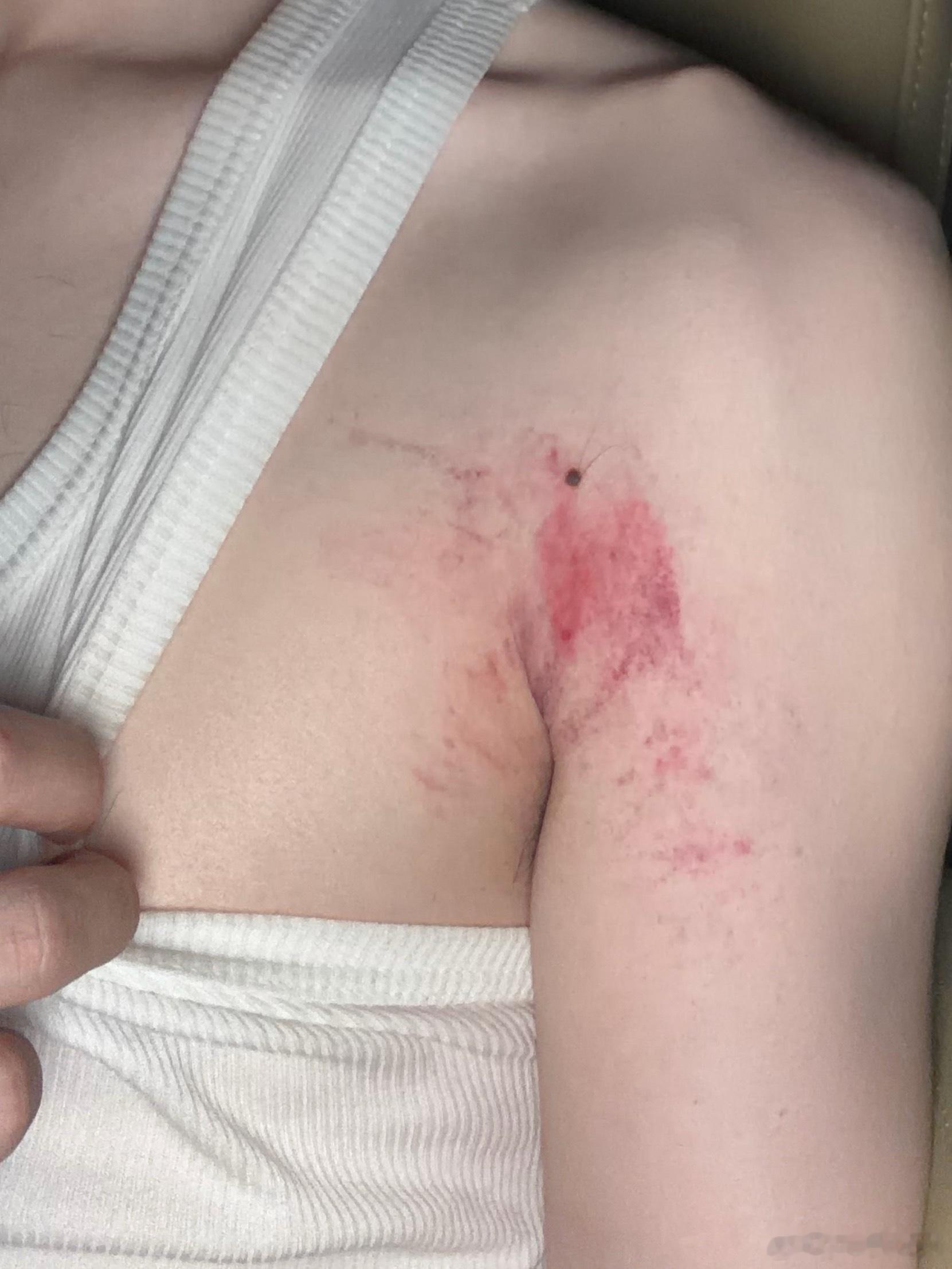 真的不想再吊威亚 我现在浑身上下散架了痛彻心扉 痛到骨子里了