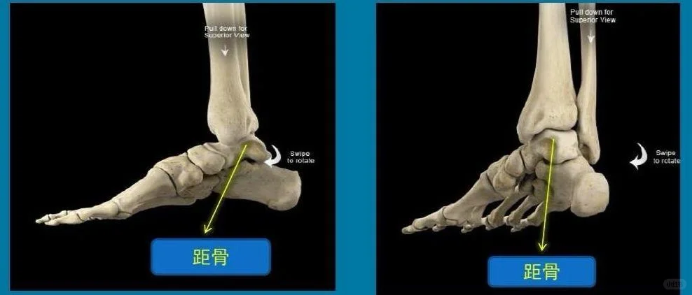 跟骨踩不上劲不是小问题