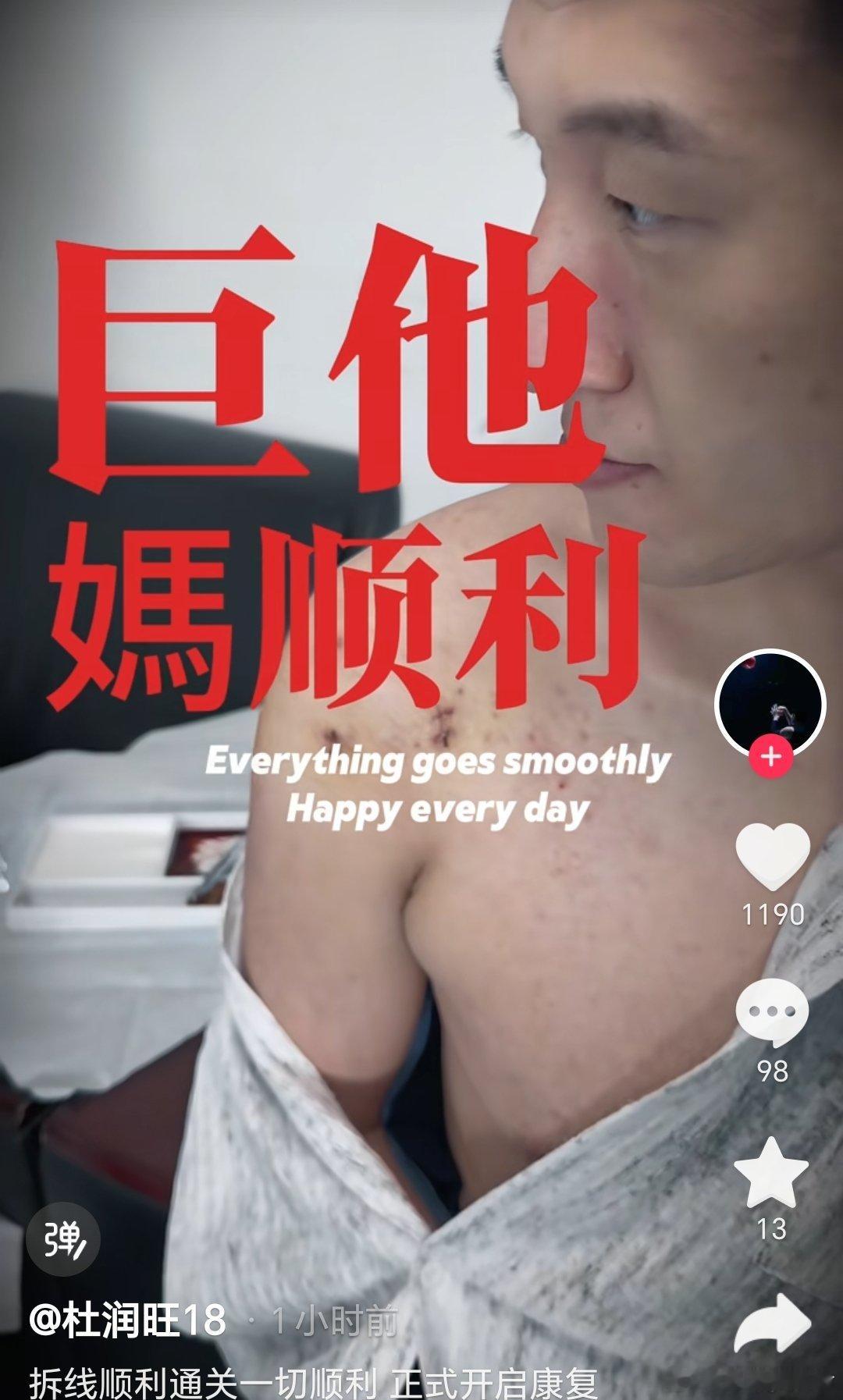 恭喜“驴哥”杜润旺顺利拆线 ，到底是有多他么顺利呢？ 